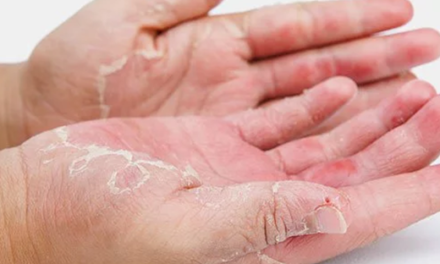 Understanding and Addressing Common Skin Issues