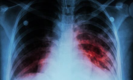 Interpreting the Disease and Treatment of Tuberculosis